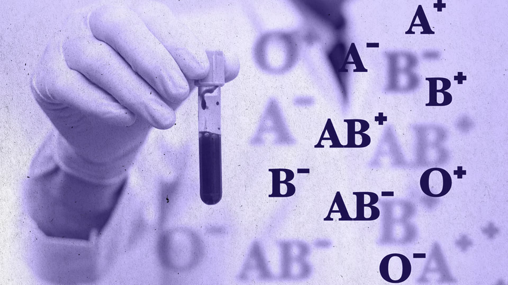 Діагностика АВО і резус-належності: обираємо методи та мінімізуємо помилки