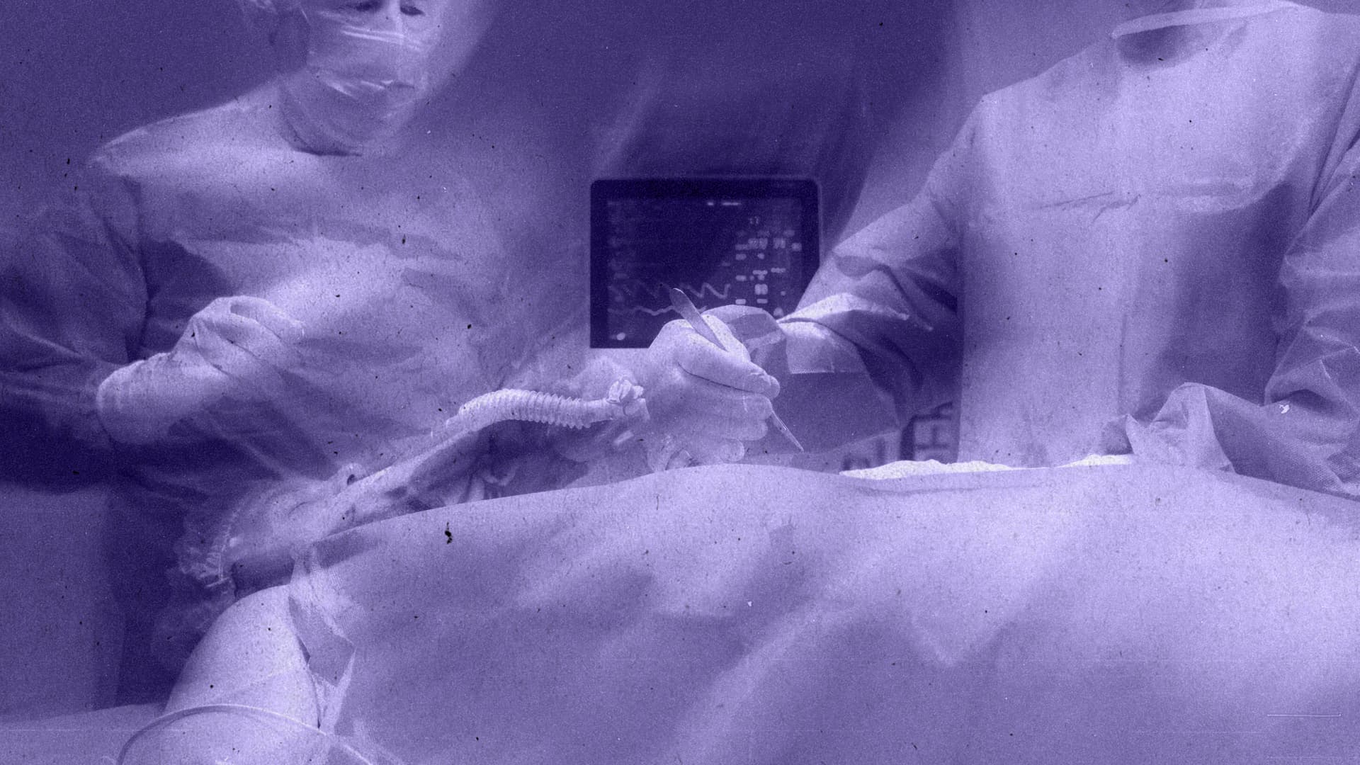 Критичні події в операційній: серцево-судинні та респіраторні невідкладні стани