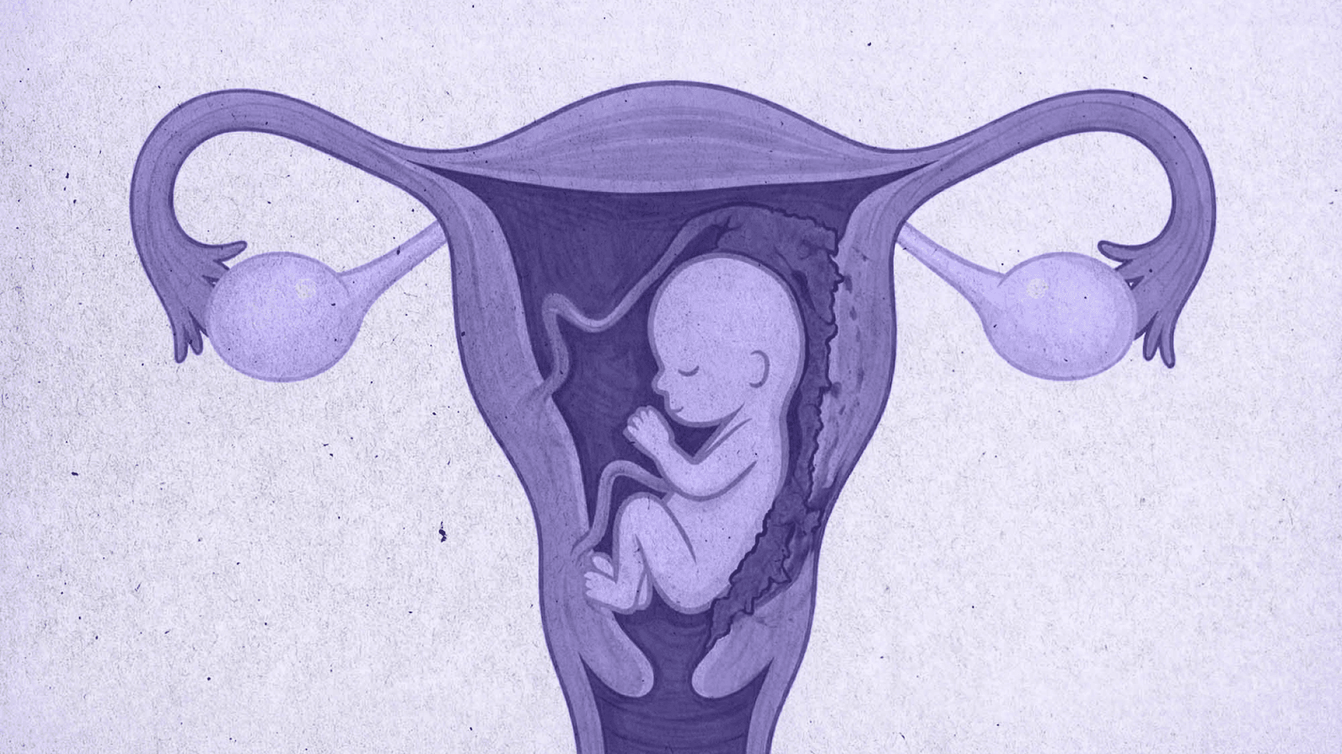 Спектр placenta accreta: сучасні алгоритми діагностики