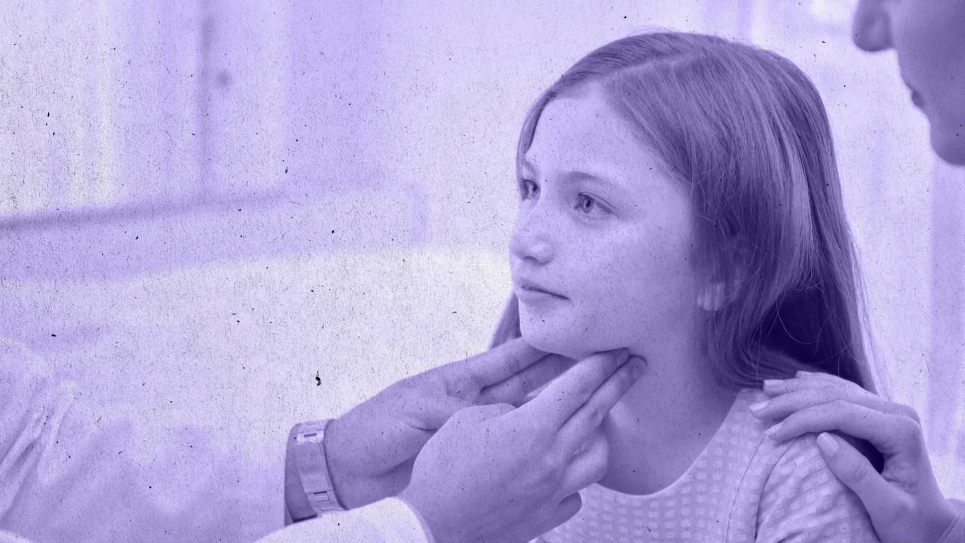 Аутоімунний тиреоїдит у дітей та підлітків