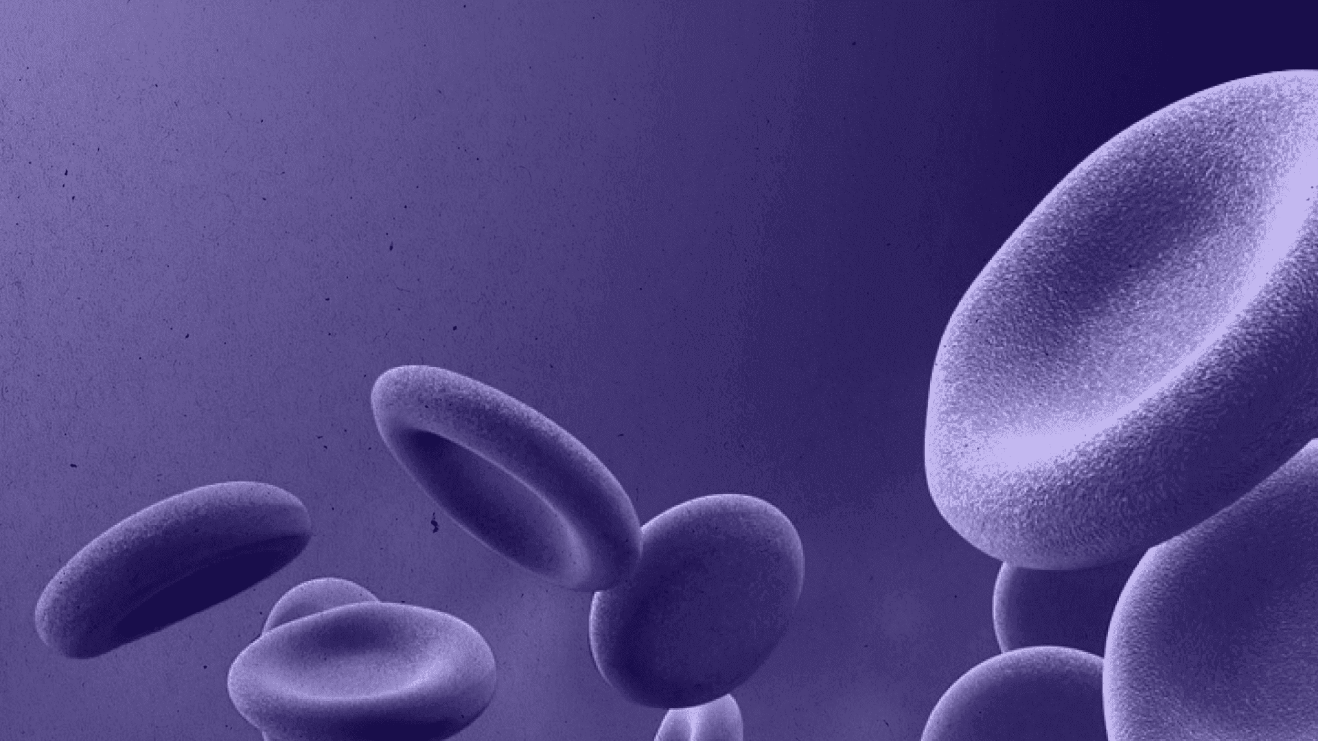 Patient Blood Management (PBM): сучасний підхід до зменшення трансфузій