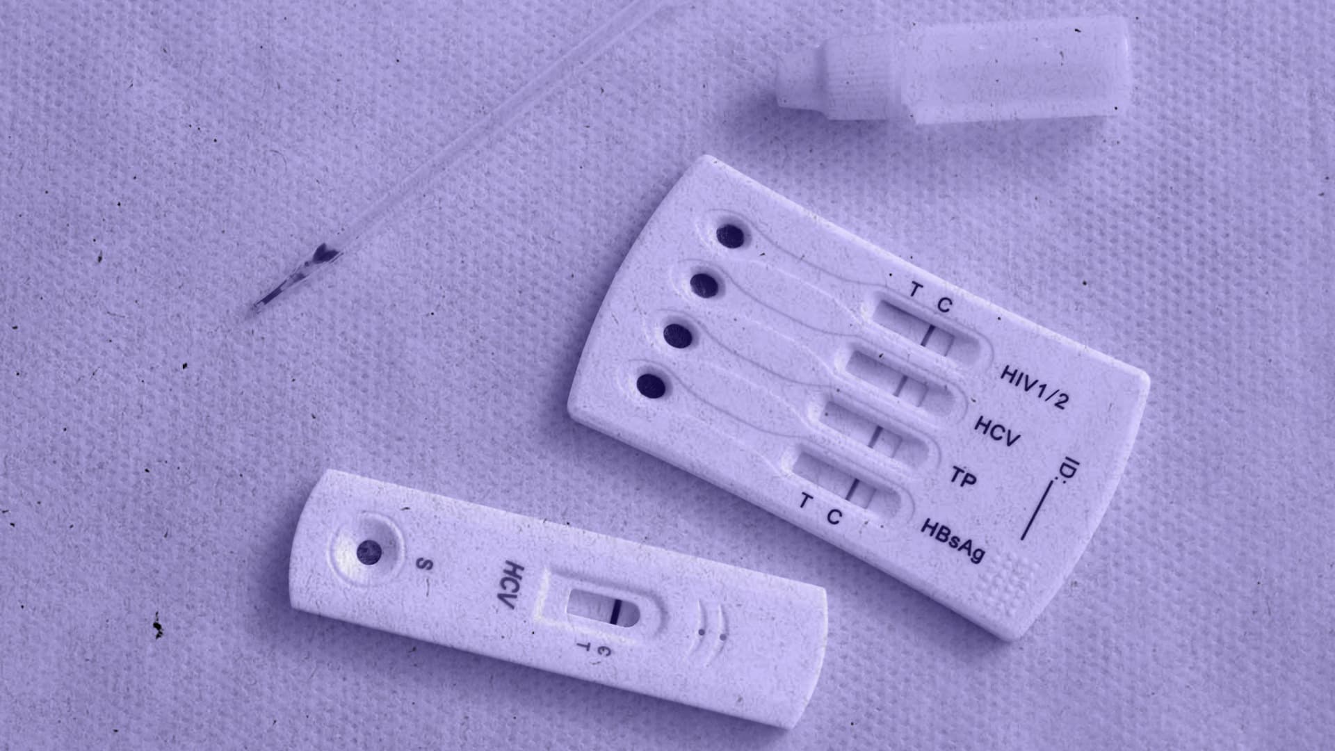 Медична сестра: контроль тестування на ВІЛ і гепатити, впровадження та дотримання стандартів