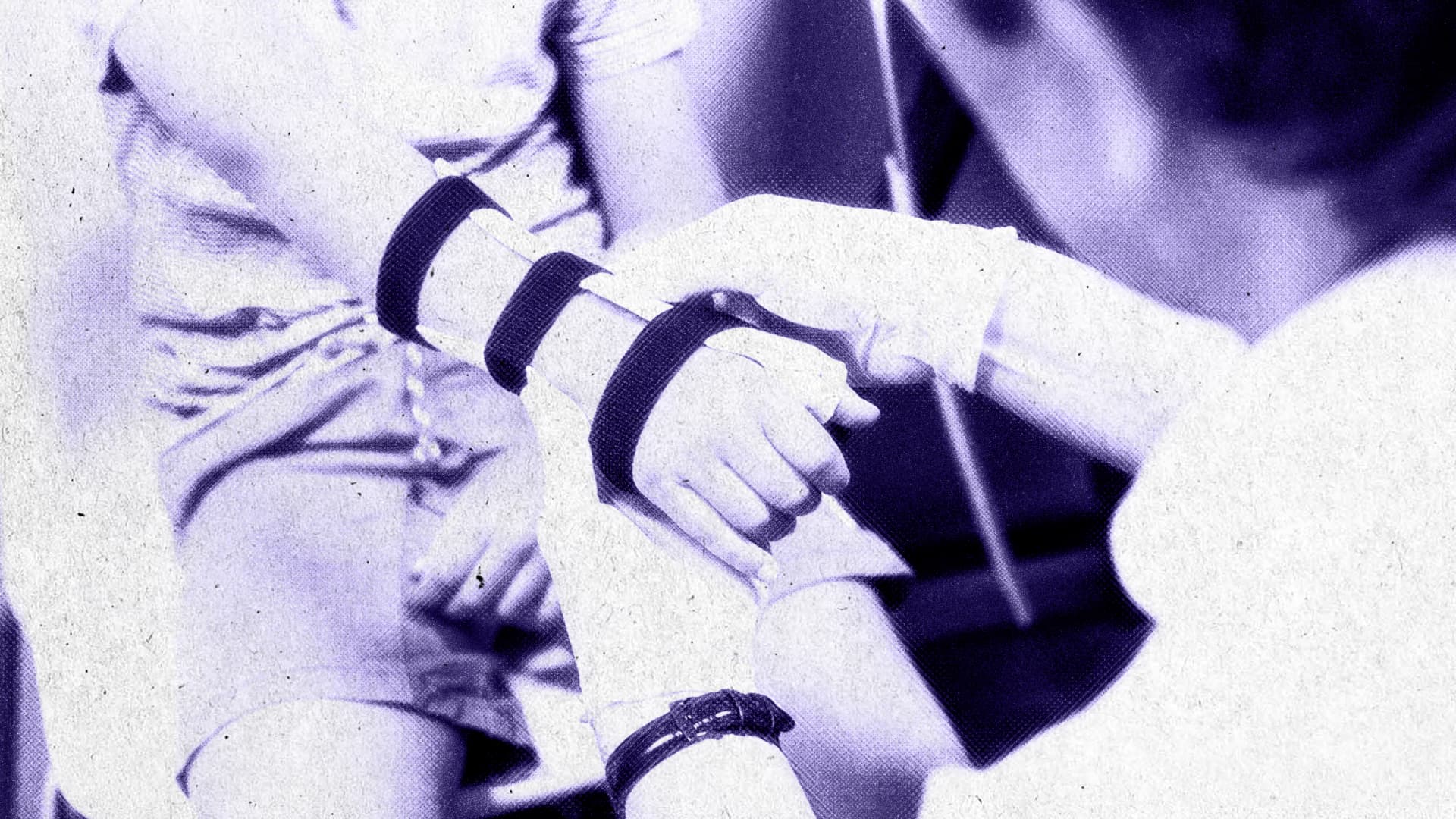 Переломи верхньої кінцівки у дітей: від «дитячої травми» до обґрунтованого вибору методу лікування